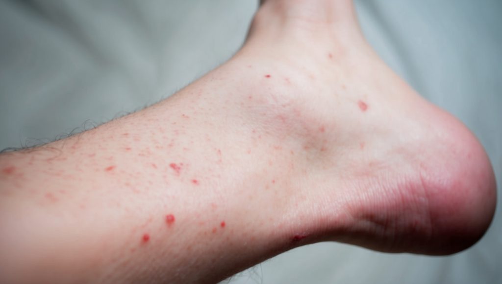 a close up of a person's foot